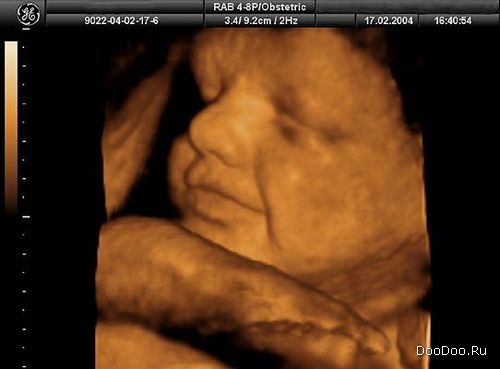 ������� � ������