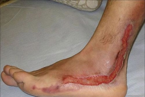 ���� ������