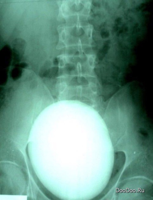 ���������� ����