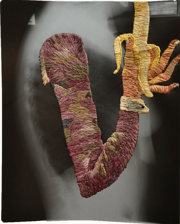 ��������� �������