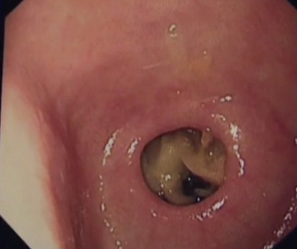 ����� ������� � �������