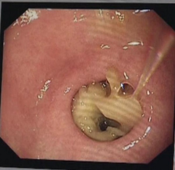 ����� ������� � �������