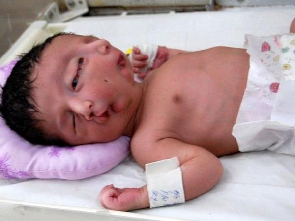 Ребенок с двумя лицами